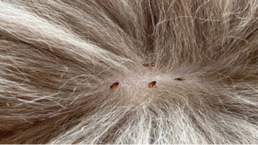 19 Natural Ways to Get Rid of Fleas